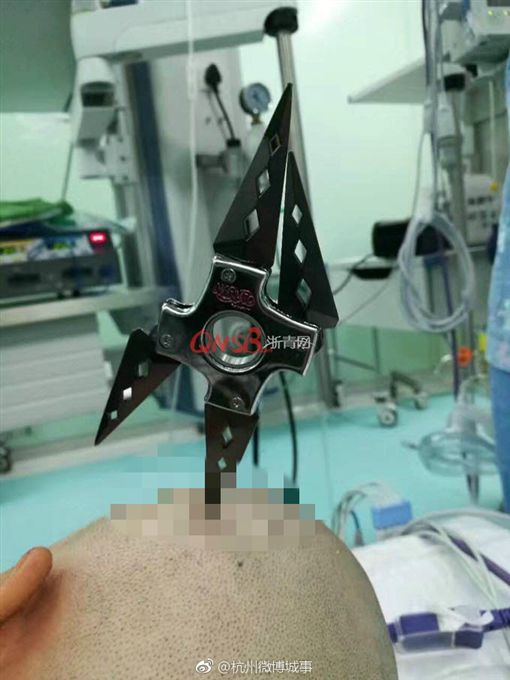 恐怖！國小女童座位上寫功課　同學射飛鏢刺穿顱骨_台東名產